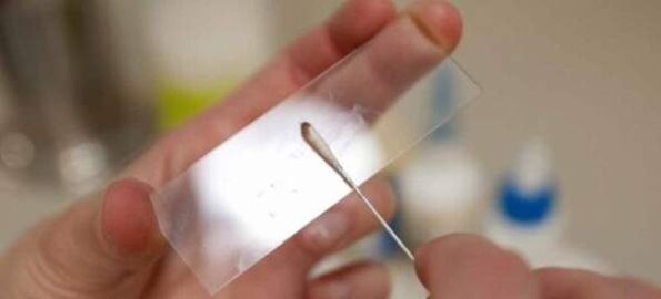 Raspagem de ovos de vermes