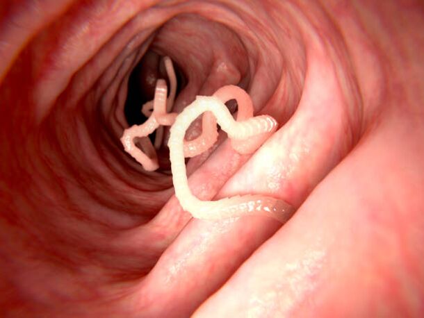 parasitas no corpo humano